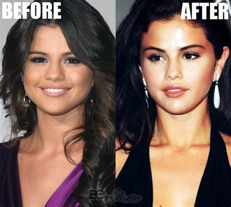 selena gomez nose|Selena Gomez Plastic Surgery Revealed! Before and After